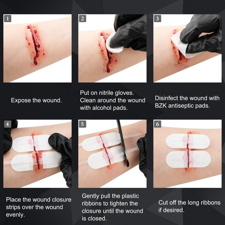 Advanced Wound Closure Kit - TriPeakMedic