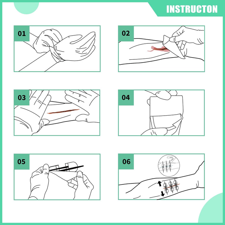 Advanced Wound Closure Kit - TriPeakMedic